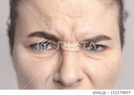 Caucasian woman shows her facial wrinkles on her face. Folds on the skin. Close up 132179607