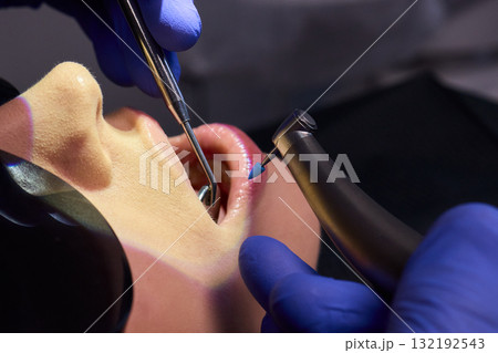 Comprehensive Dental Hygiene Procedure Conducted with a Specialized Dental Drill Tool 132192543