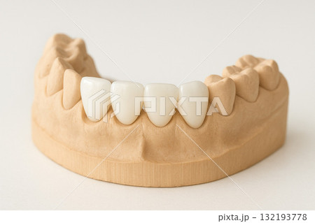 ジルコニア クラウン 入れ歯 歯科治療 132193778