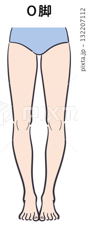 O脚のイラスト 132207112