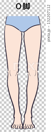 O脚のイラスト 132207112