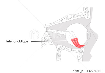 Inferior oblique - Human eye muscle in labeled chart responsible for extorsion and upward eye movement, essential  132236406
