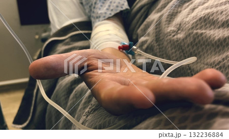 Close-up of a patient hand with an intravenous catheter and medical tubing in a hospital bed, symbolizing healthcare, illness, recovery, and medical treatment 132236884