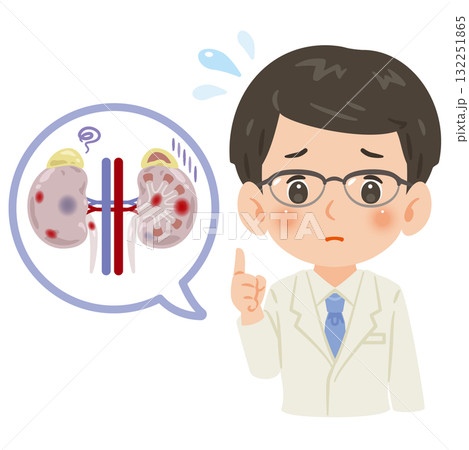 不健康な腎臓と白衣を着た男性医師 上半身イラスト 不健康な腎臓と白衣を着た男性医師 上半身イラスト 132251865
