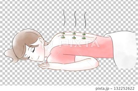 一位女士背部艾灸的水彩畫 一位女士背部艾灸的水彩畫 132252622