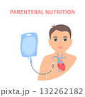 Child receiving parenteral nutrition through a central intravenous access 132262182