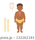Child receiving parenteral nutrition through a central intravenous access 132262183