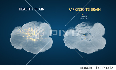 Parkinsons Thalamocortical Dopaminergic Output Comparison 132274312