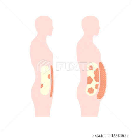 肥満体型と標準体型の腹部イラスト / 内臓脂肪と皮下脂肪 132283682