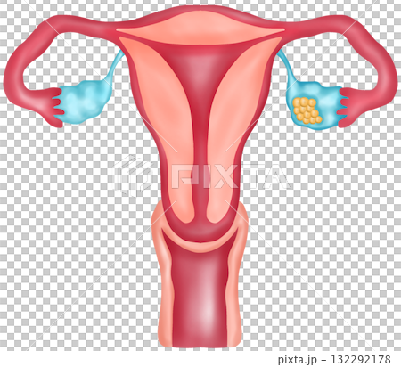 Ovarian Cancer, Hand-drawn Watercolor Illustration Ovarian Cancer, Hand-drawn Watercolor Illustration 132292178