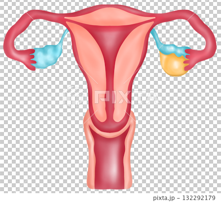 Female Reproductive System with Ovarian Cyst, Hand-drawn Watercolor Illustration Female Reproductive System with Ovarian Cyst, Hand-drawn Watercolor Illustration 132292179