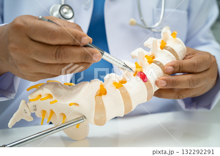Doctor with lumbar vertebra bone skeleton and nerve model for treatment in the orthopedic department. 132292291