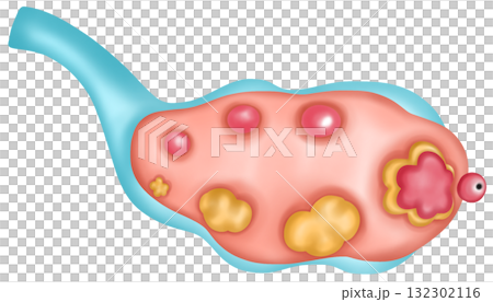 ovary cross-section isolated, Hand-drawn Watercolor Illustration 132302116