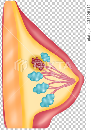 Breast Cancer, Hand-drawn Watercolor Illustration 132306156