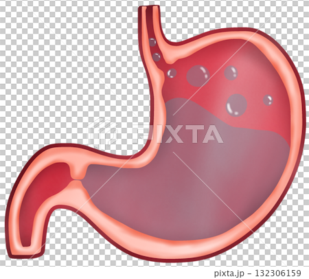 Anatomy of the Stomach in Acid Reflux, GERD 132306159