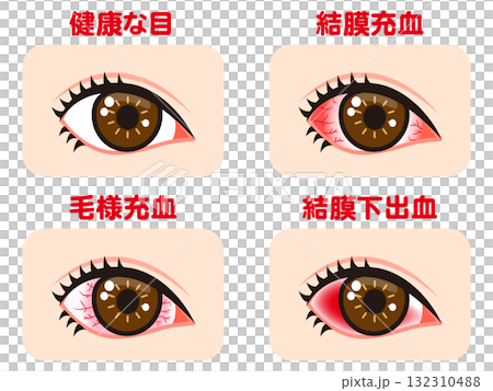 插圖素材集充血的眼睛 插圖素材集充血的眼睛 132310488