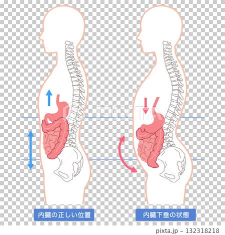 內臟下垂：內臟器官下垂的一種狀況 132318218