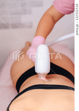 Specialist performing laser hair removal procedure in beauty salon 132332316