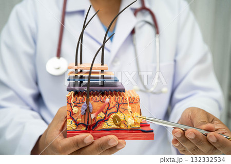 Hair transplant, Asian dermatologist doctor holding skin structure anatomy model for treatment in hospital. Hair transplant, Asian dermatologist doctor holding skin structure anatomy model for treatment in hospital. 132332534
