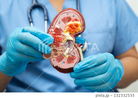 Chronic kidney disease, doctor with model for treatment urinary system, urology, Estimated glomerular filtration rate eGFR. Chronic kidney disease, doctor with model for treatment urinary system, urology, Estimated glomerular filtration rate eGFR. 132332535