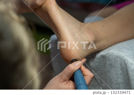 Electric foot peeling device for home pedicure. 132339471