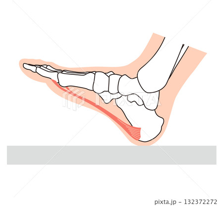 足底筋膜炎　足底筋膜　足底腱膜　足の筋肉 132372272
