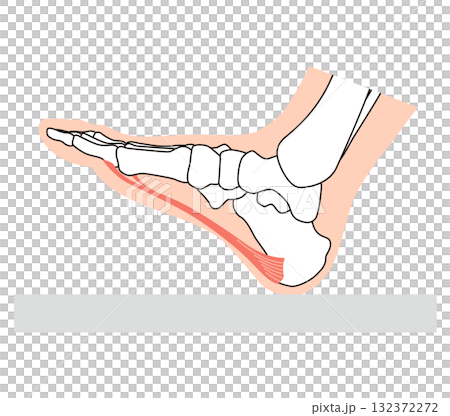 足底筋膜炎　足底筋膜　足底腱膜　足の筋肉 132372272