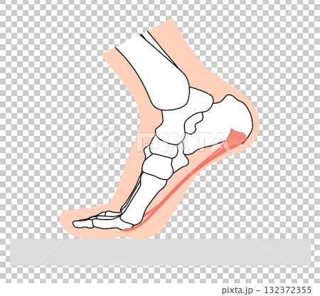 足底筋膜炎　足底筋膜　足底腱膜　足の筋肉 132372355