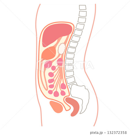 横からの腹部断面 腹水 横からの腹部断面 腹水 132372358