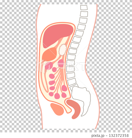 横からの腹部断面 腹水 横からの腹部断面 腹水 132372358