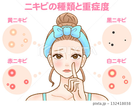 大人ニキビと肌荒れに困る大人女性のイラスト素材 大人ニキビと肌荒れに困る大人女性のイラスト素材 132418038
