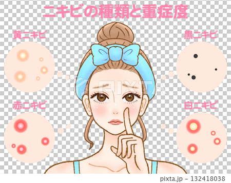 大人ニキビと肌荒れに困る大人女性のイラスト素材 大人ニキビと肌荒れに困る大人女性のイラスト素材 132418038