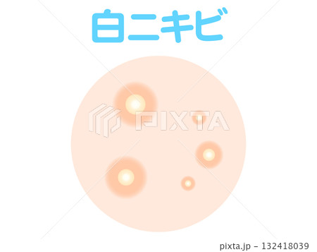 シンプルな白ニキビのイラスト素材 132418039