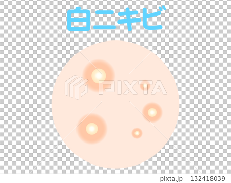 シンプルな白ニキビのイラスト素材 132418039