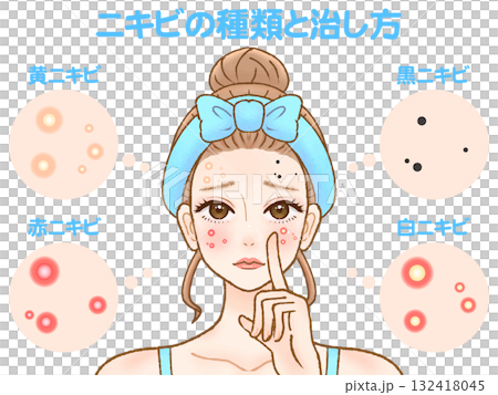 患有成人痤瘡和皮膚粗糙的成年女性的插圖材料3 132418045