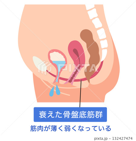 衰えた骨盤底筋群 骨盤底筋 衰えた骨盤底筋群 骨盤底筋 132427474