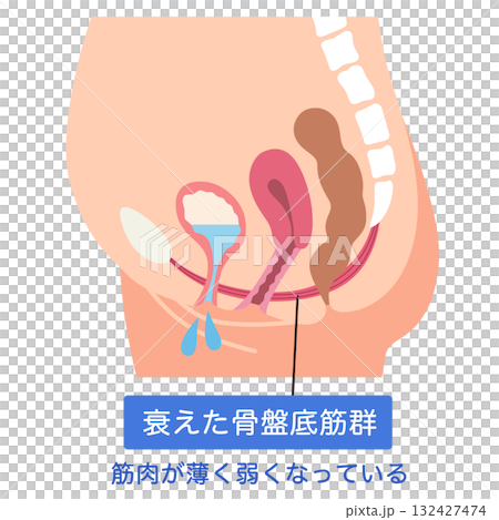 衰えた骨盤底筋群 骨盤底筋 衰えた骨盤底筋群 骨盤底筋 132427474