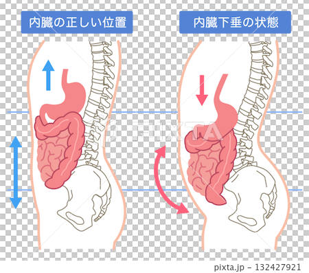 內臟下垂：內臟器官下垂的一種狀況 132427921
