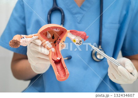 Uterus, doctor holding human anatomy model for study diagnosis and treatment in hospital. Uterus, doctor holding human anatomy model for study diagnosis and treatment in hospital. 132434607