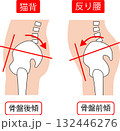 反り腰の骨盤前傾と猫背の骨盤後傾 132446276