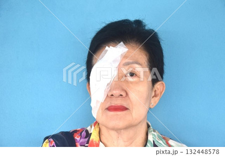 elder woman covering protection on right eye after cataract surgery in blue background elder woman covering protection on right eye after cataract surgery in blue background 132448578