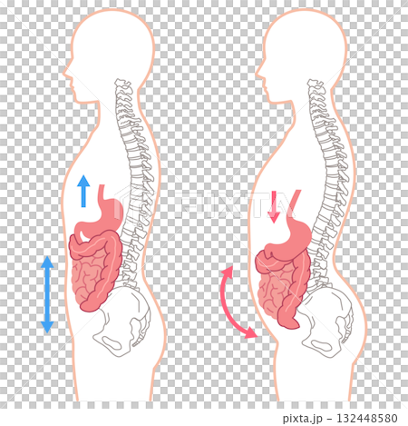 內臟下垂:內臟器官下垂的一種狀況 內臟下垂:內臟器官下垂的一種狀況 132448580