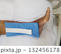 Purpura caused by cancer on leg is side effect of chemotherapy or caused by cancer cells interfering with platelet production in the bone marrow. 132456178