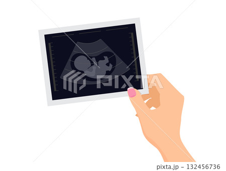 Female hands holding ultrasound image of baby stock illustration. Female hands holding ultrasound image of baby stock illustration. 132456736