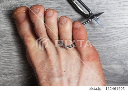 leg and scissors are nearby. The concept of selecting a tool for foot care leg and scissors are nearby. The concept of selecting a tool for foot care 132461605