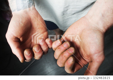 A man shows his fingernails. Hand Cleanliness Check A man shows his fingernails. Hand Cleanliness Check 132461615