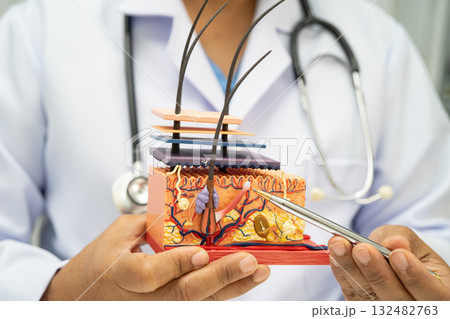 Asian dermatologist doctor holding skin structure model anatomy for treatment in hospital, hair transplant. Asian dermatologist doctor holding skin structure model anatomy for treatment in hospital, hair transplant. 132482763