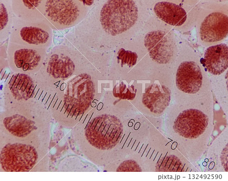 体細胞分裂の後期の様子 体細胞分裂の後期の様子 132492590