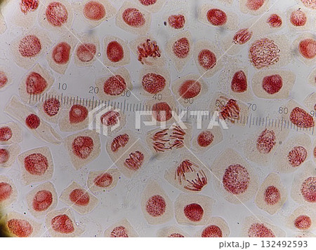 光学顕微鏡で見る体細胞分裂の観察 132492593