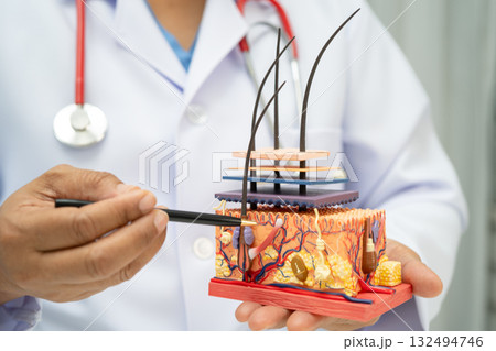 Hair transplant, Asian dermatologist doctor holding skin structure anatomy model for treatment in hospital. 132494746